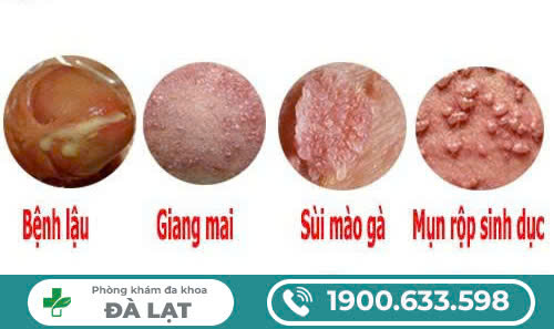 Hình ảnh minh họa